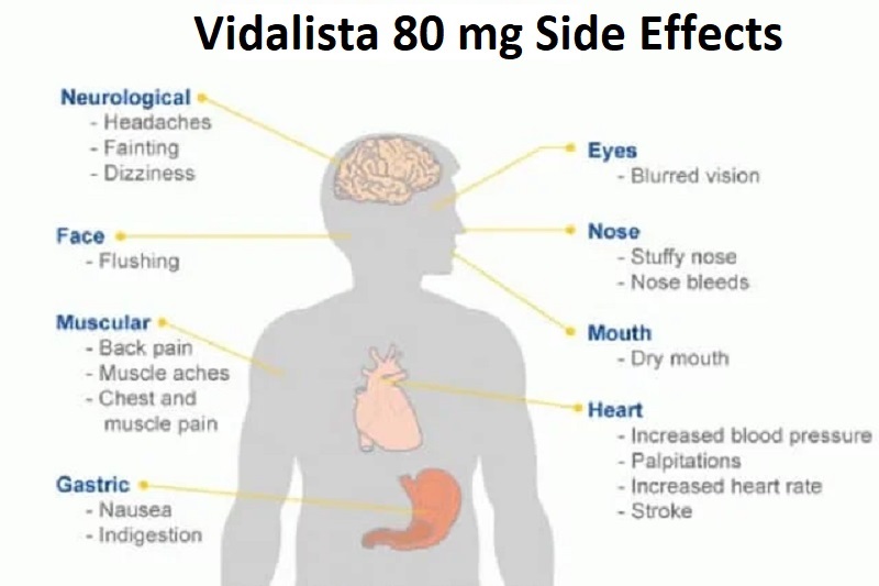 Vidalista Black 80 mg Side Effects